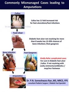 callus foot - Podiatry Doctor