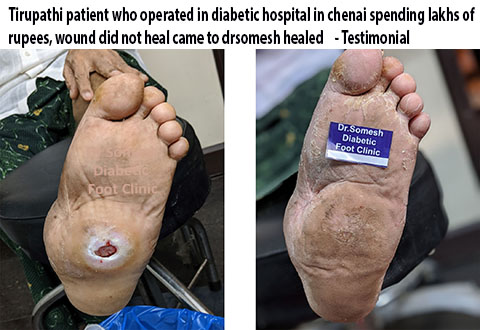 Diabetic foot specialists