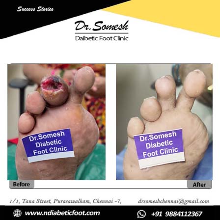 podiatrist chennai | diabetic foot clinic